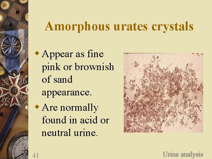 Amorphous urates crystals w Appear as fine pink or brownish of sand appearance. w