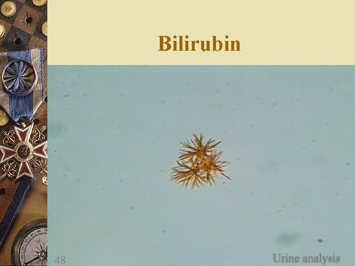 Bilirubin 48 Urine analysis 