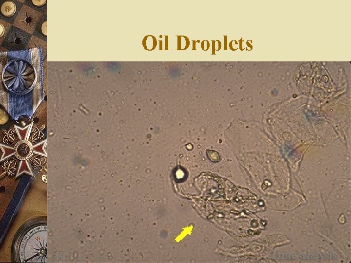 Oil Droplets 49 Urine analysis 