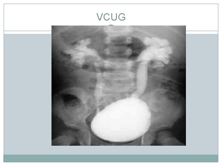 VCUG VCUG