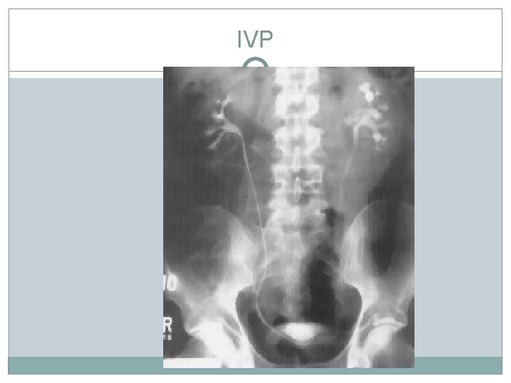 IVP IVP