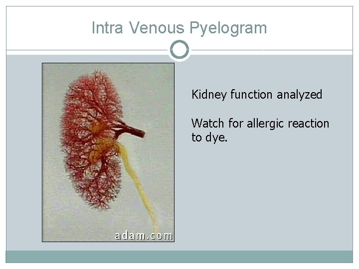 Intra Venous Pyelogram Kidney function analyzed Watch for allergic reaction to dye. Intra Venous Pyelogram Kidney function analyzed Watch for allergic reaction to dye.