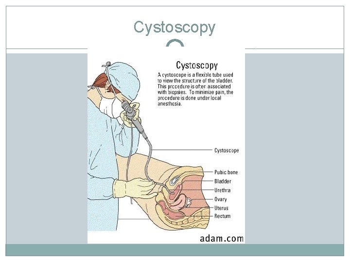 Cystoscopy Cystoscopy