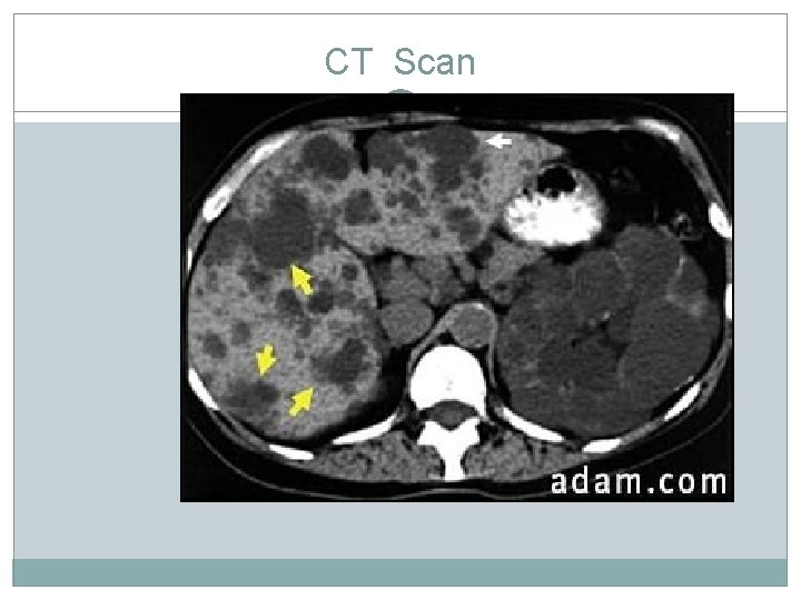 CT Scan CT Scan