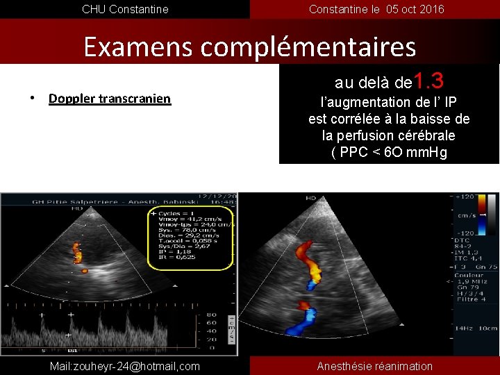  CHU Constantine le 05 oct 2016 Examens complémentaires • Doppler transcranien Mail: zouheyr-24@hotmail,