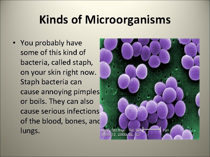 Kinds of Microorganisms • You probably have some of this kind of bacteria, called