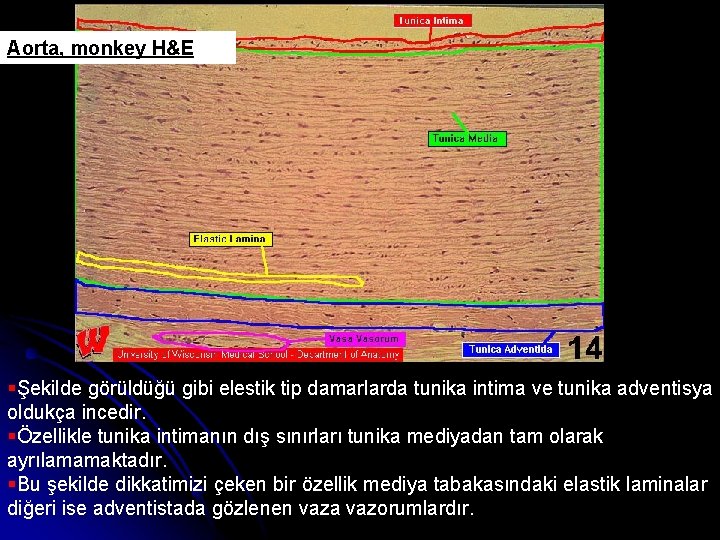 Aorta, monkey H&E §Şekilde görüldüğü gibi elestik tip damarlarda tunika intima ve tunika adventisya