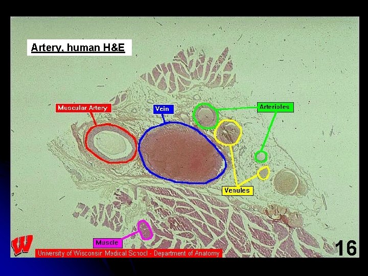 Artery, human H&E 