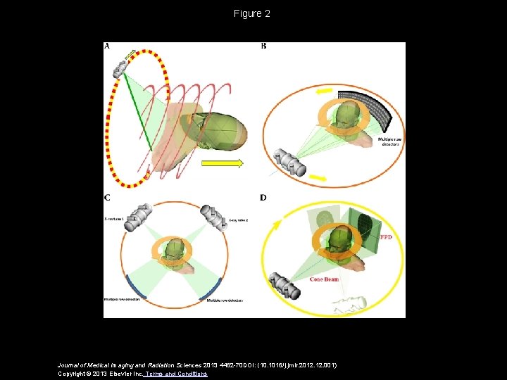 Figure 2 Journal of Medical Imaging and Radiation Sciences 2013 4462 -70 DOI: (10.