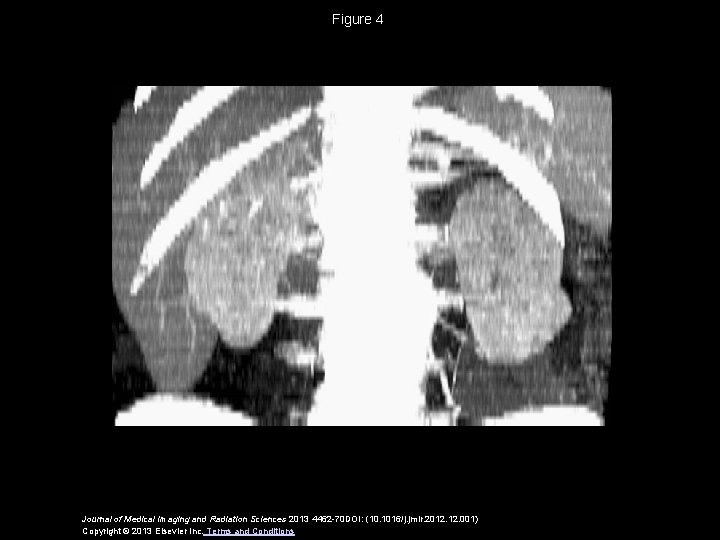 Figure 4 Journal of Medical Imaging and Radiation Sciences 2013 4462 -70 DOI: (10.
