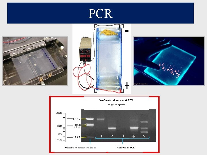 PCR Verificación del producto de PCR en gel de agarosa Marcador de tamaño molecular PCR Verificación del producto de PCR en gel de agarosa Marcador de tamaño molecular