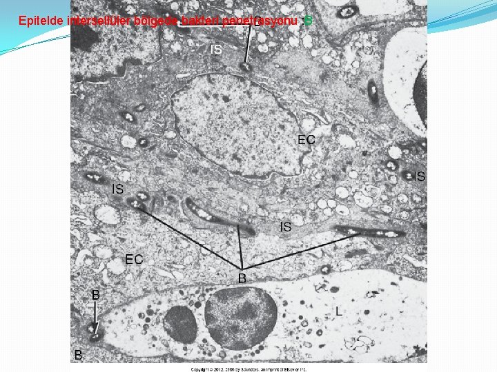 Epitelde intersellüler bölgede bakteri penetrasyonu : B 