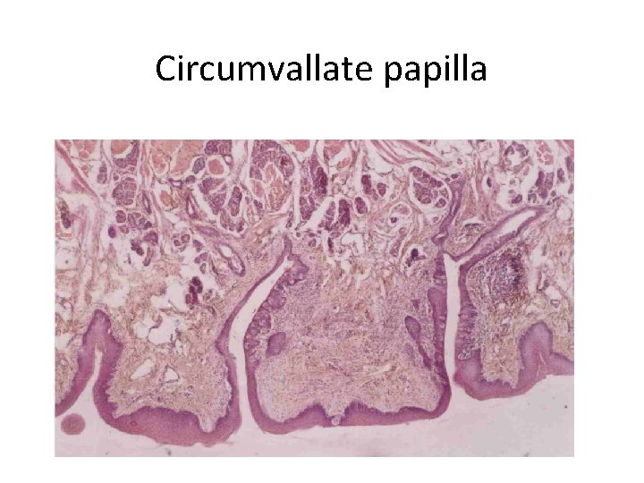 Circumvallate papilla Circumvallate papilla