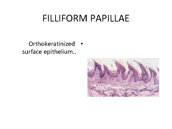 FILLIFORM PAPILLAE Orthokeratinized • surface epithelium. . FILLIFORM PAPILLAE Orthokeratinized • surface epithelium. .