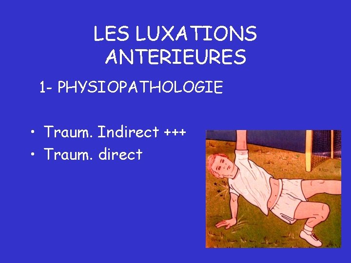 LES LUXATIONS ANTERIEURES 1 - PHYSIOPATHOLOGIE • Traum. Indirect +++ • Traum. direct 