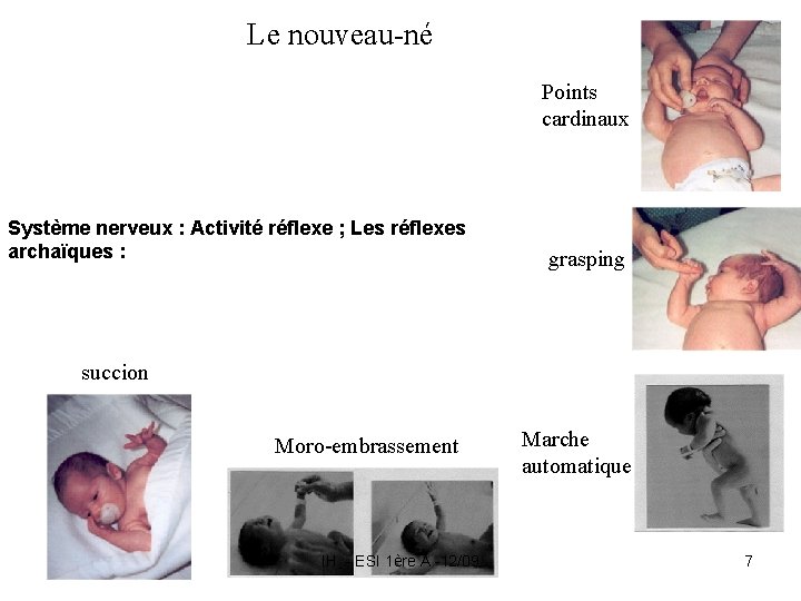 Le nouveau-né Points cardinaux Système nerveux : Activité réflexe ; Les réflexes archaïques : Le nouveau-né Points cardinaux Système nerveux : Activité réflexe ; Les réflexes archaïques :
