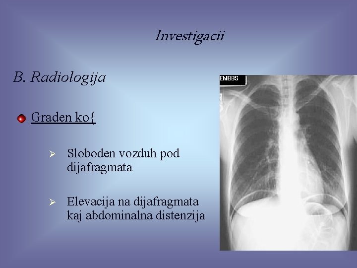 Investigacii B. Radiologija Graden ko{ Ø Sloboden vozduh pod dijafragmata Ø Elevacija na dijafragmata