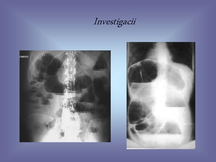 Investigacii 30 