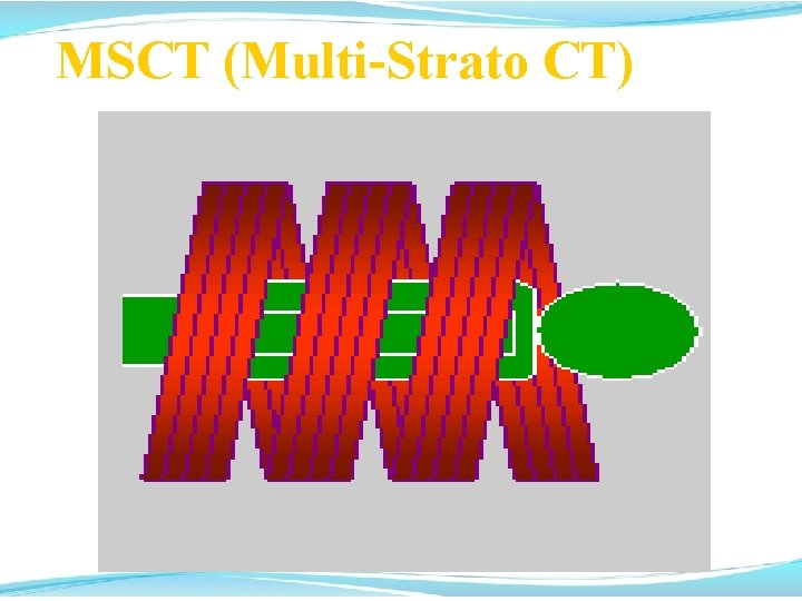 MSCT (Multi-Strato CT) 