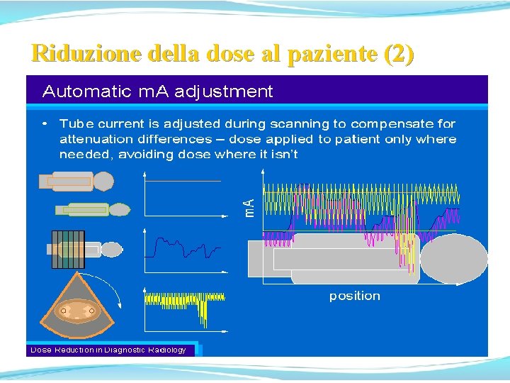 Riduzione della dose al paziente (2) Riduzione della dose al paziente (2)