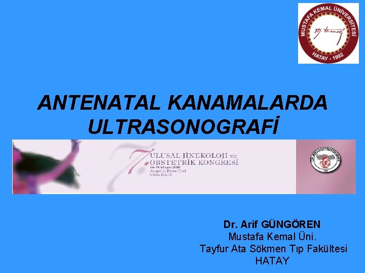 ANTENATAL KANAMALARDA ULTRASONOGRAFİ Dr. Arif GÜNGÖREN Mustafa Kemal Üni. Tayfur Ata Sökmen Tıp Fakültesi ANTENATAL KANAMALARDA ULTRASONOGRAFİ Dr. Arif GÜNGÖREN Mustafa Kemal Üni. Tayfur Ata Sökmen Tıp Fakültesi