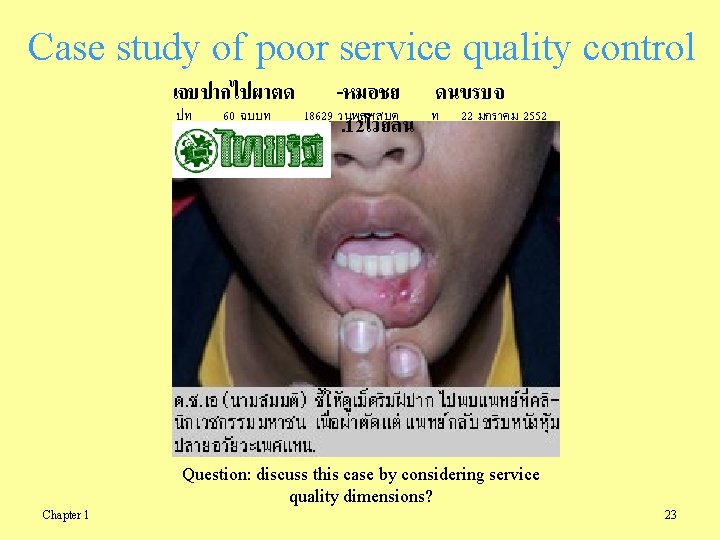 Case study of poor service quality control เจบปากไปผาตด -หมอชย ดนขรบจ ปท 60 ฉบบท 18629