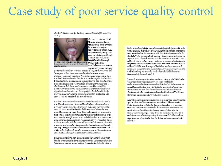 Case study of poor service quality control Chapter 1 24 