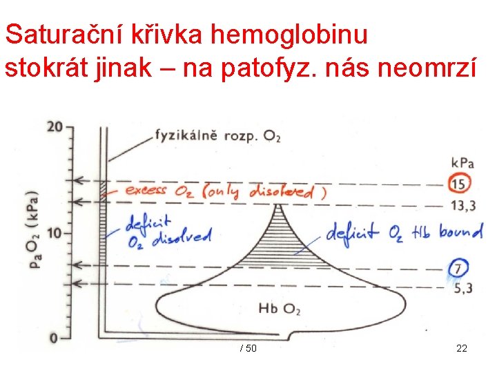 Saturační křivka hemoglobinu stokrát jinak – na patofyz. nás neomrzí / 50 22 