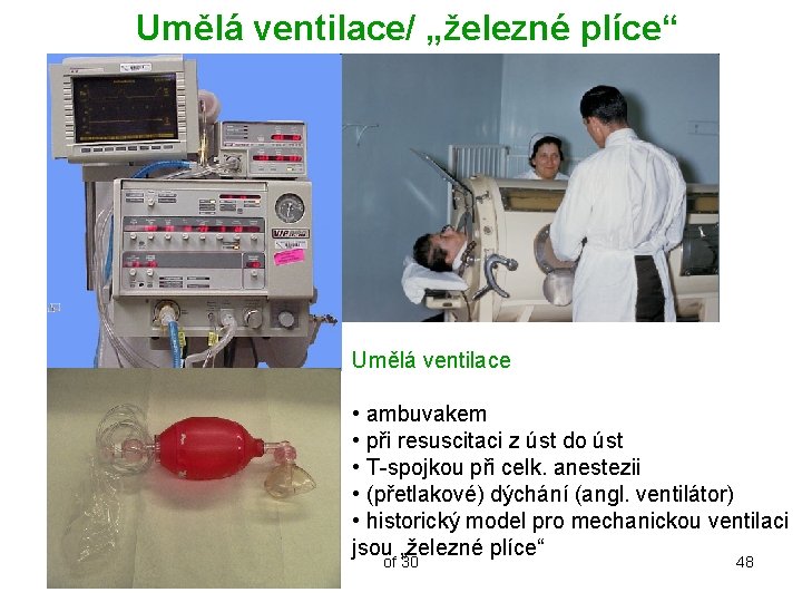 Umělá ventilace/ „železné plíce“ Umělá ventilace • ambuvakem • při resuscitaci z úst do