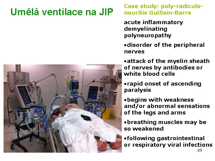  Umělá ventilace na JIP Case study: poly-radiculoneuritis Guillain-Barre acute inflammatory demyelinating polyneuropathy •