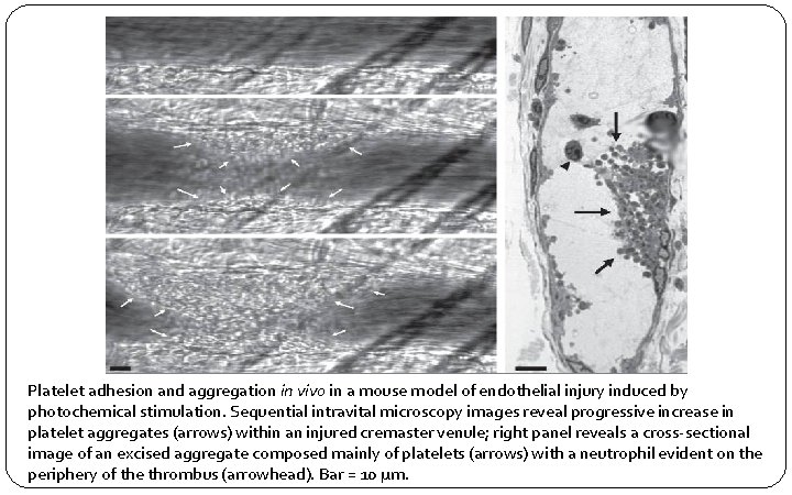 Platelet adhesion and aggregation in vivo in a mouse model of endothelial injury induced