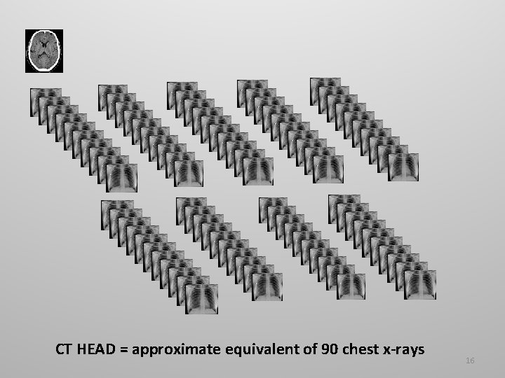 CT HEAD = approximate equivalent of 90 chest x-rays 16 
