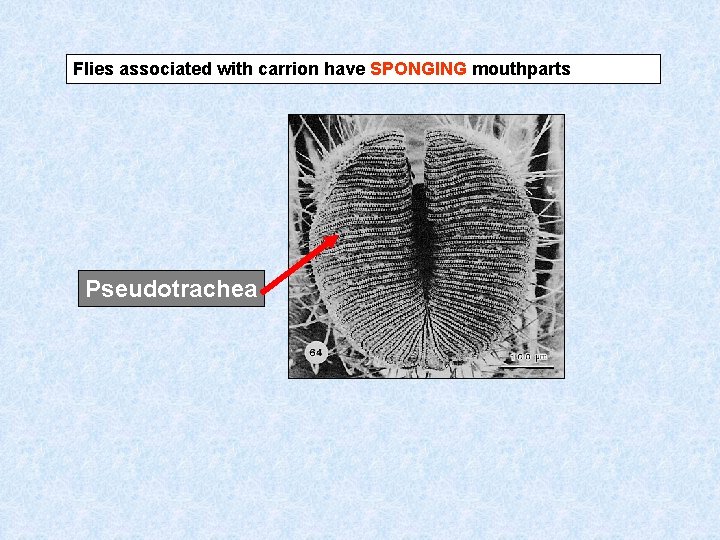 Flies associated with carrion have SPONGING mouthparts Pseudotrachea 