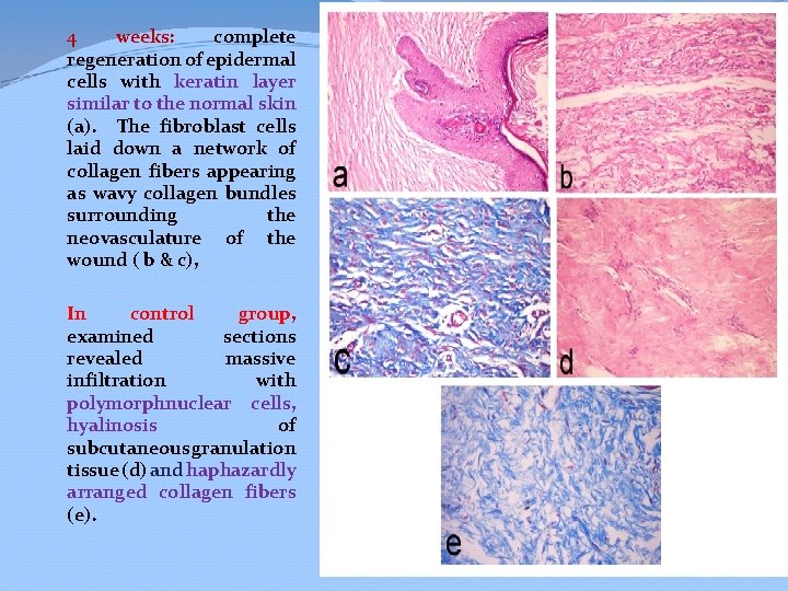 4 weeks: complete regeneration of epidermal cells with keratin layer similar to the normal