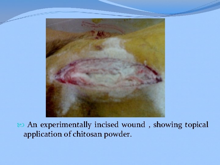  An experimentally incised wound , showing topical application of chitosan powder. 