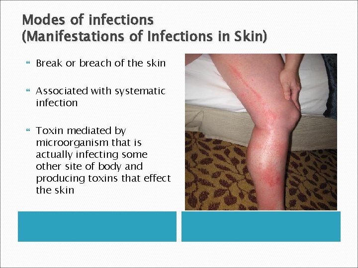 Modes of infections (Manifestations of Infections in Skin) Break or breach of the skin