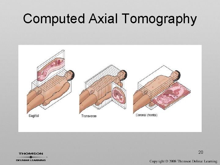 Computed Axial Tomography 20 