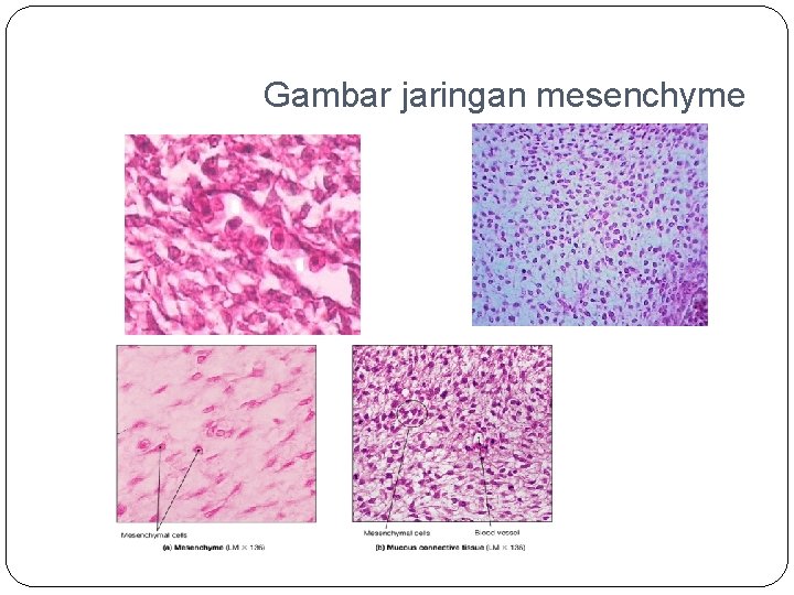 Gambar jaringan mesenchyme 