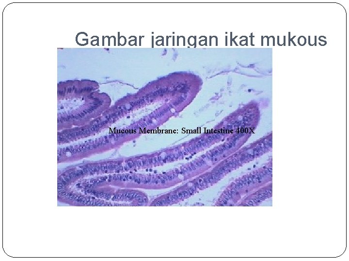 Jaringan ikat bawah kulit banyak mengandung