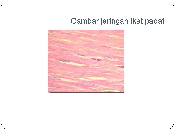 Gambar jaringan ikat padat 