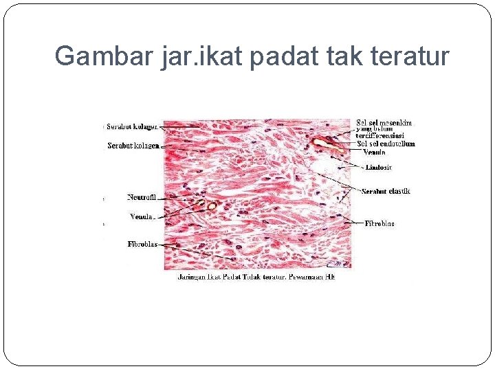 Gambar jar. ikat padat tak teratur 