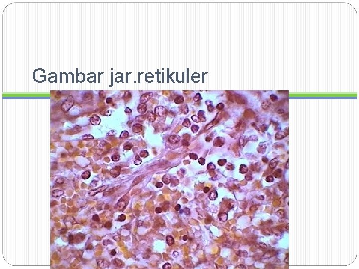 Gambar jar. retikuler 