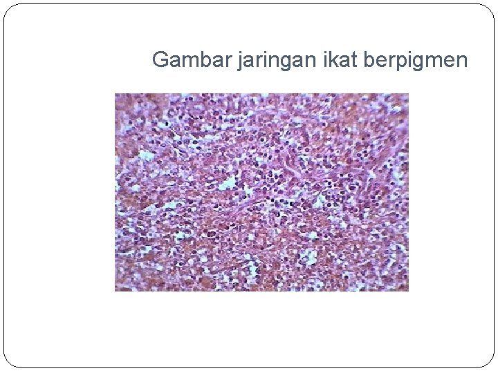 Gambar jaringan ikat berpigmen 
