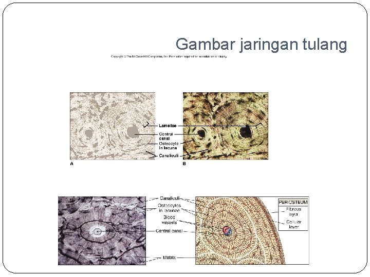 Gambar jaringan tulang 