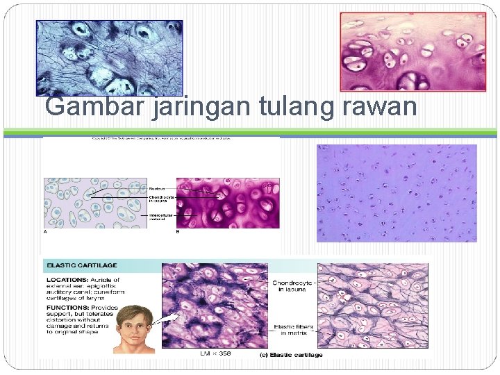 Gambar jaringan tulang rawan 