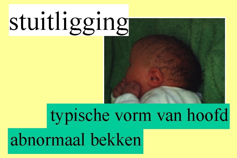 stuitligging typische vorm van hoofd abnormaal bekken 