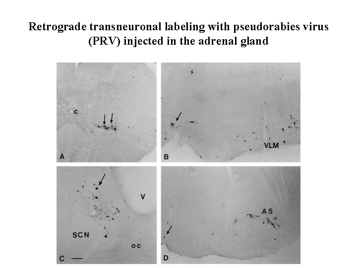 Retrograde transneuronal labeling with pseudorabies virus (PRV) injected in the adrenal gland 