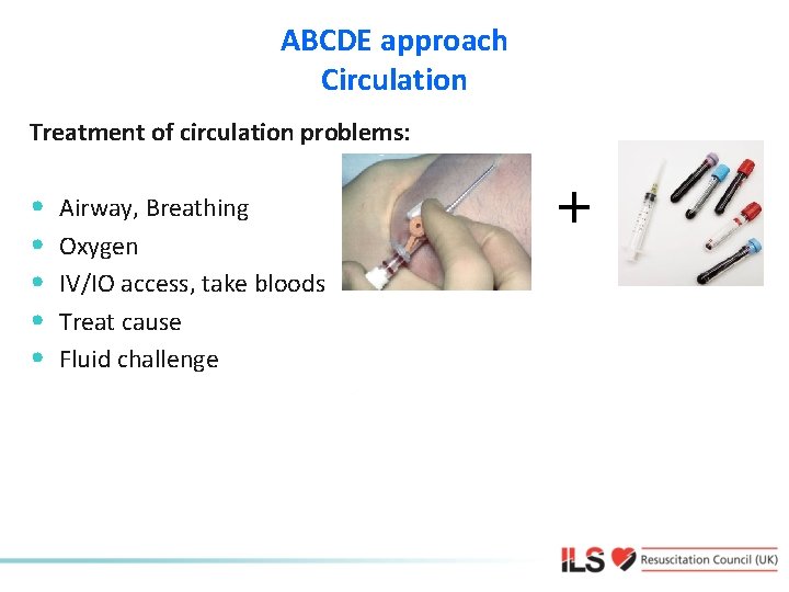 ABCDE approach Circulation Treatment of circulation problems: • • • Airway, Breathing Oxygen IV/IO
