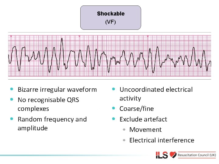 Shockable (VF) Shockable • Bizarre irregular waveform • No recognisable QRS • complexes Random