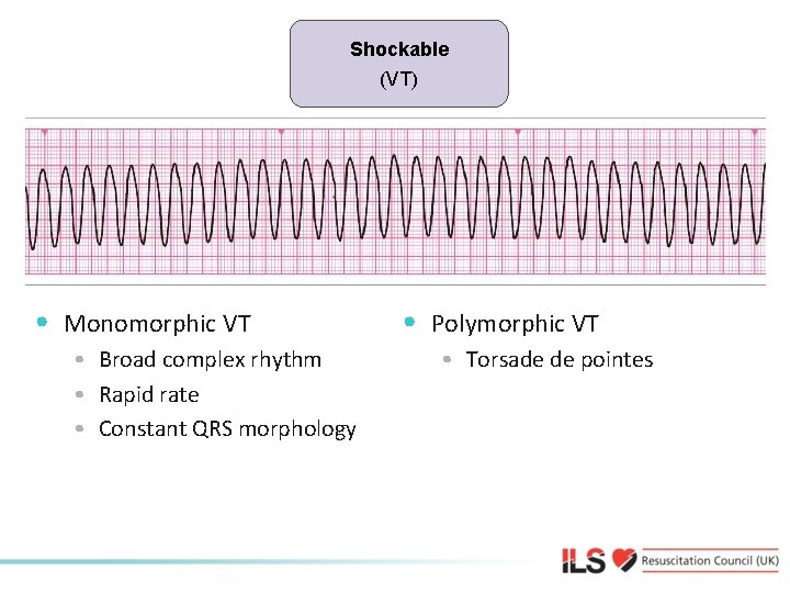Shockable (VT) Shockable • Monomorphic VT • Broad complex rhythm • Rapid rate •